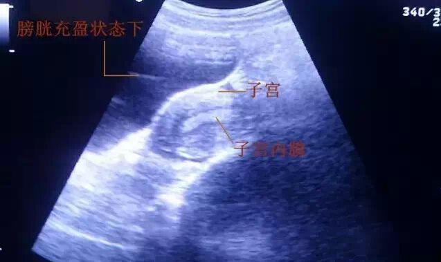 远方的呼唤 第3页